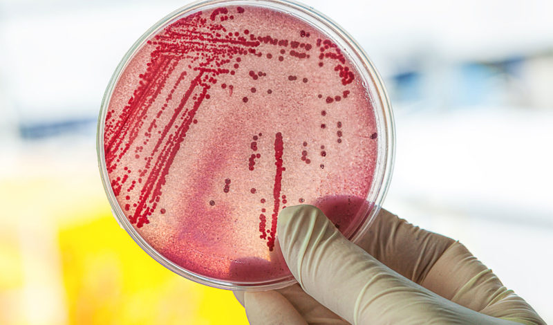 E-coli-Bakterien - das machen sie im Darm. Foto Petrischale